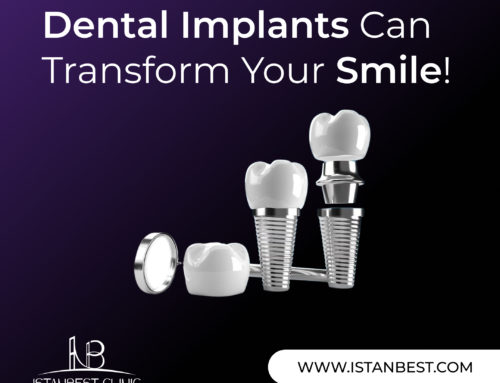 What You Should Know After Receiving Dental Implants
