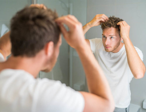 8 Ways to Unraveling the Mystery of Hair Loss: Strategies, Solutions, and Self-Care