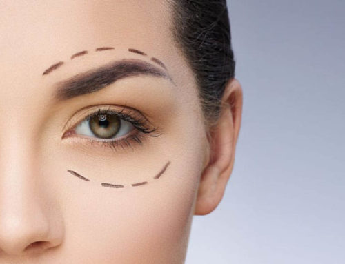 Eyelid Surgery (Blepharoplasty) – Surgery, Recovery and Risks