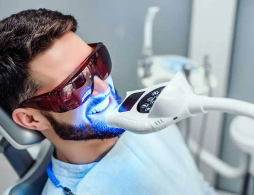Laser Teeth Whitening – Effectiveness and Considerations