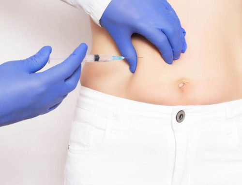 Stomach Botox Procedures – An Answer For Any Question You Have